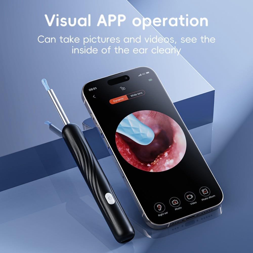 Oraluxe™ Smart Ear Wax Removal Device with HD Camera